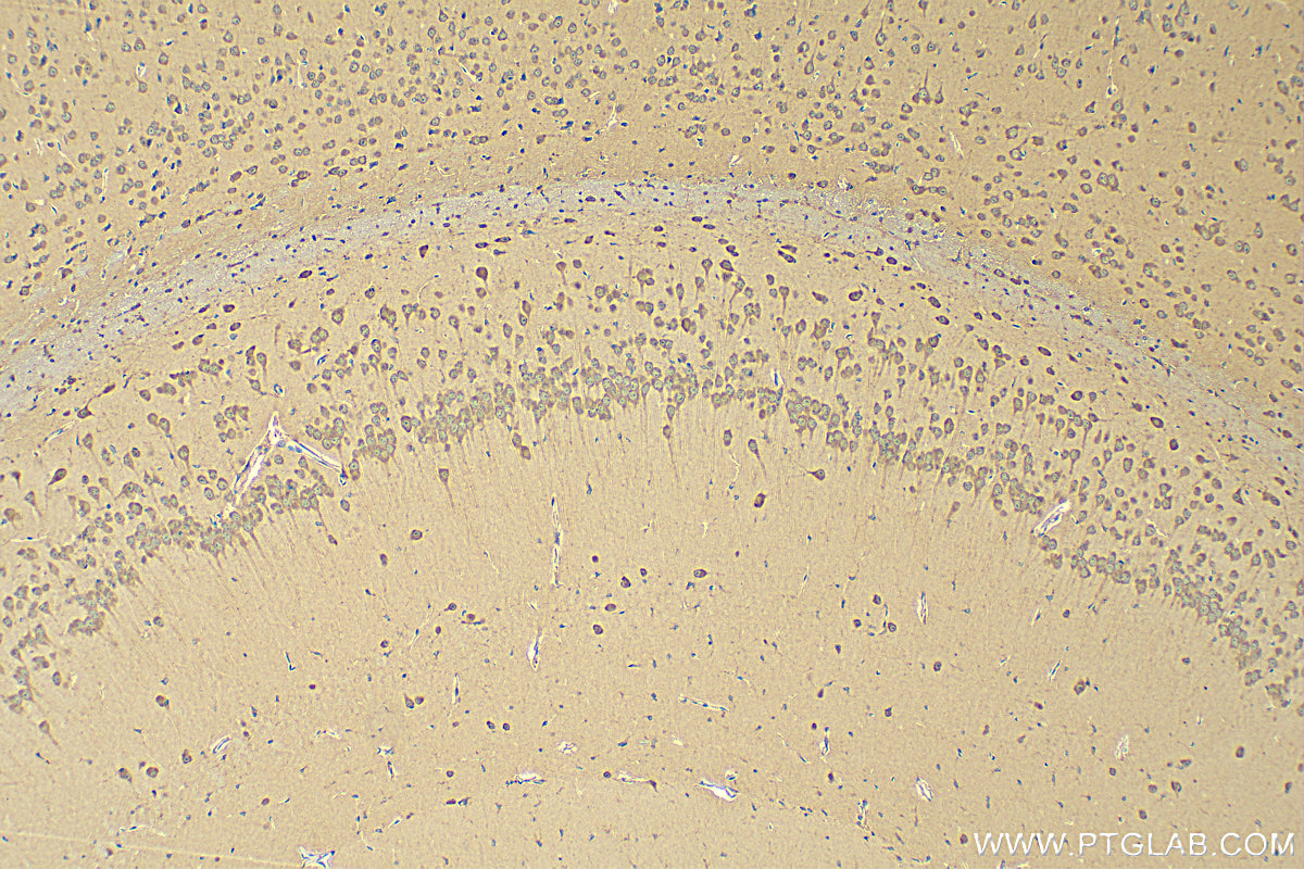 IHC staining of mouse brain using 20229-1-AP