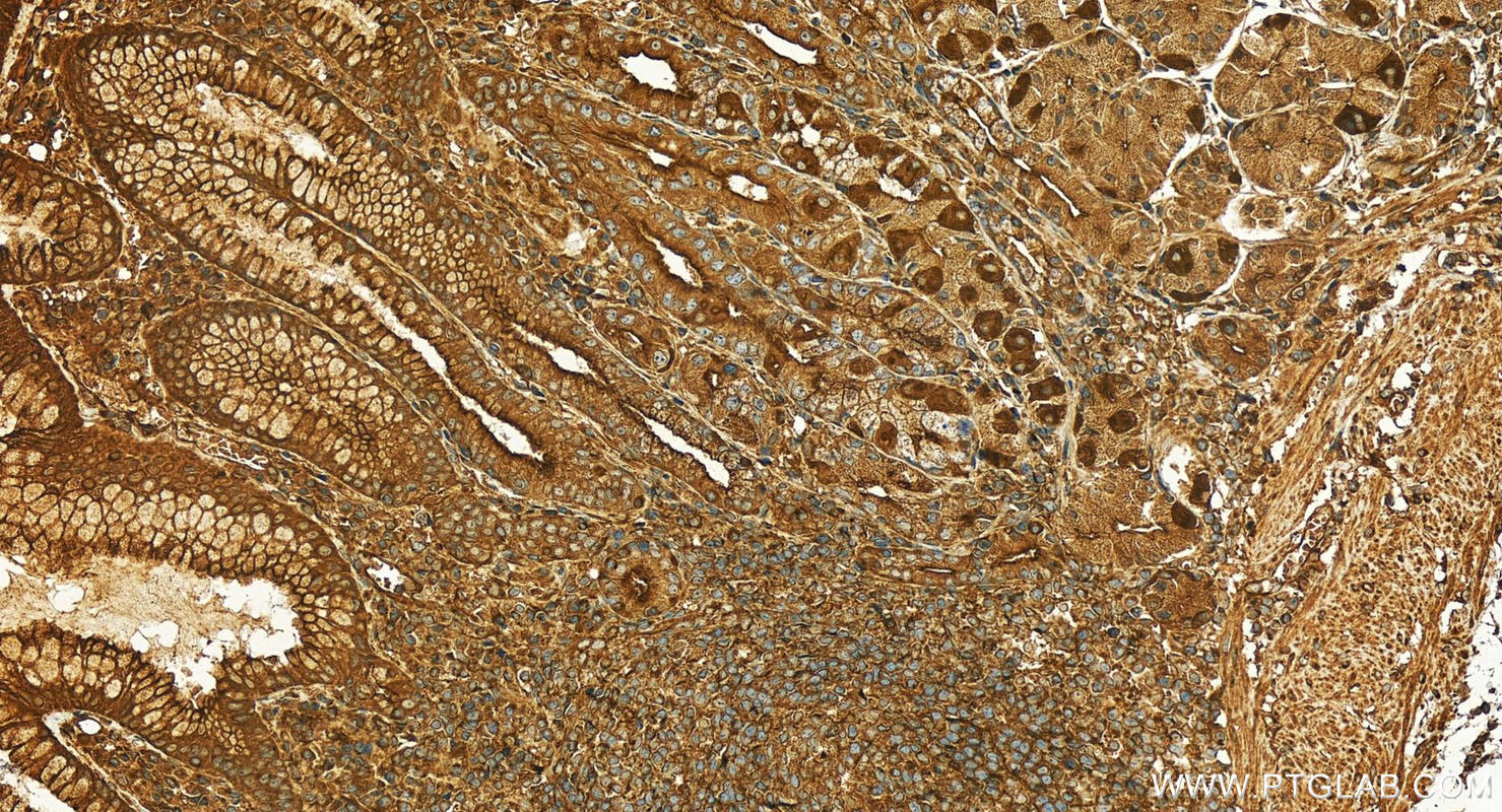 IHC staining of human stomach using 28498-1-AP