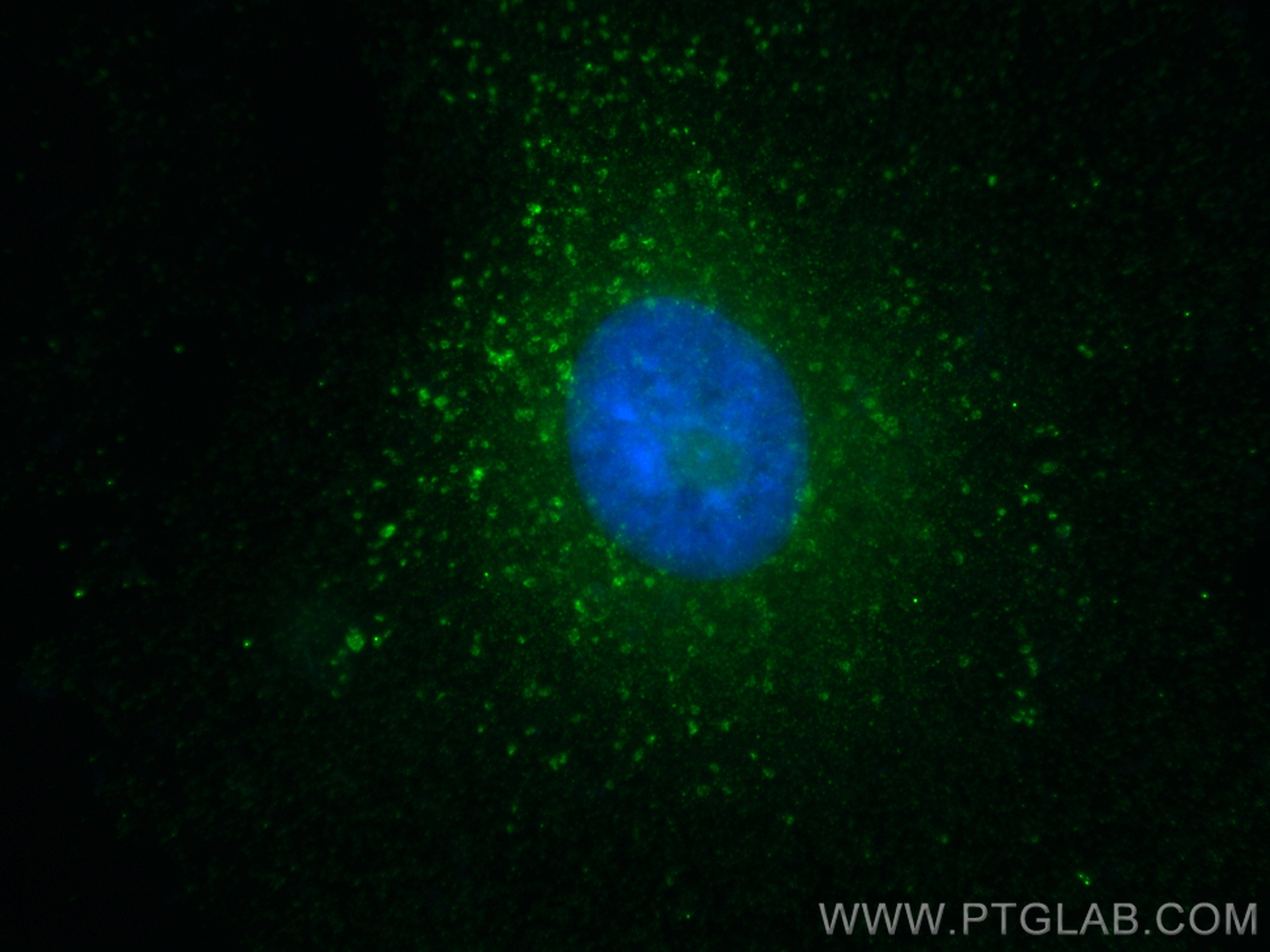 IF Staining of A549 using 28498-1-AP