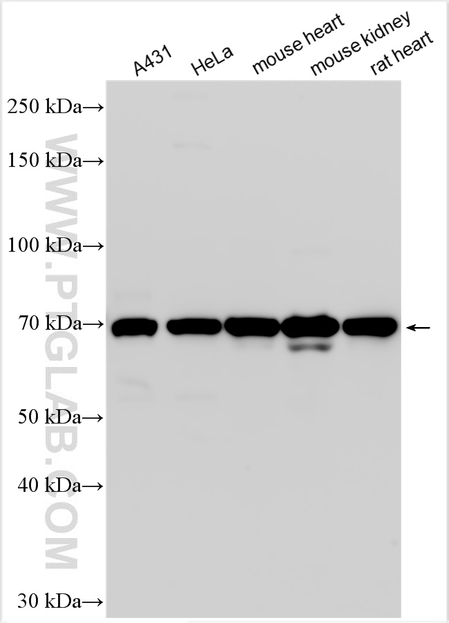 WB analysis using 14594-1-AP