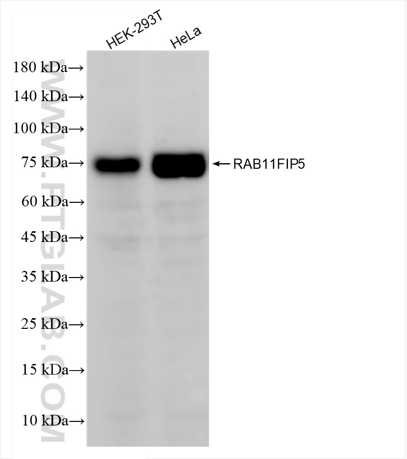 RAB11FIP5