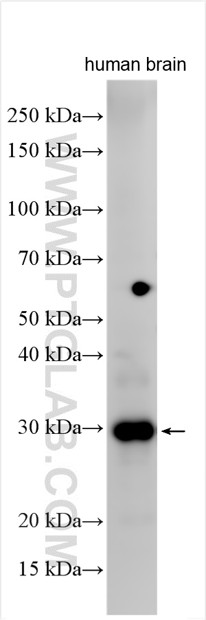 WB analysis using 29927-1-AP