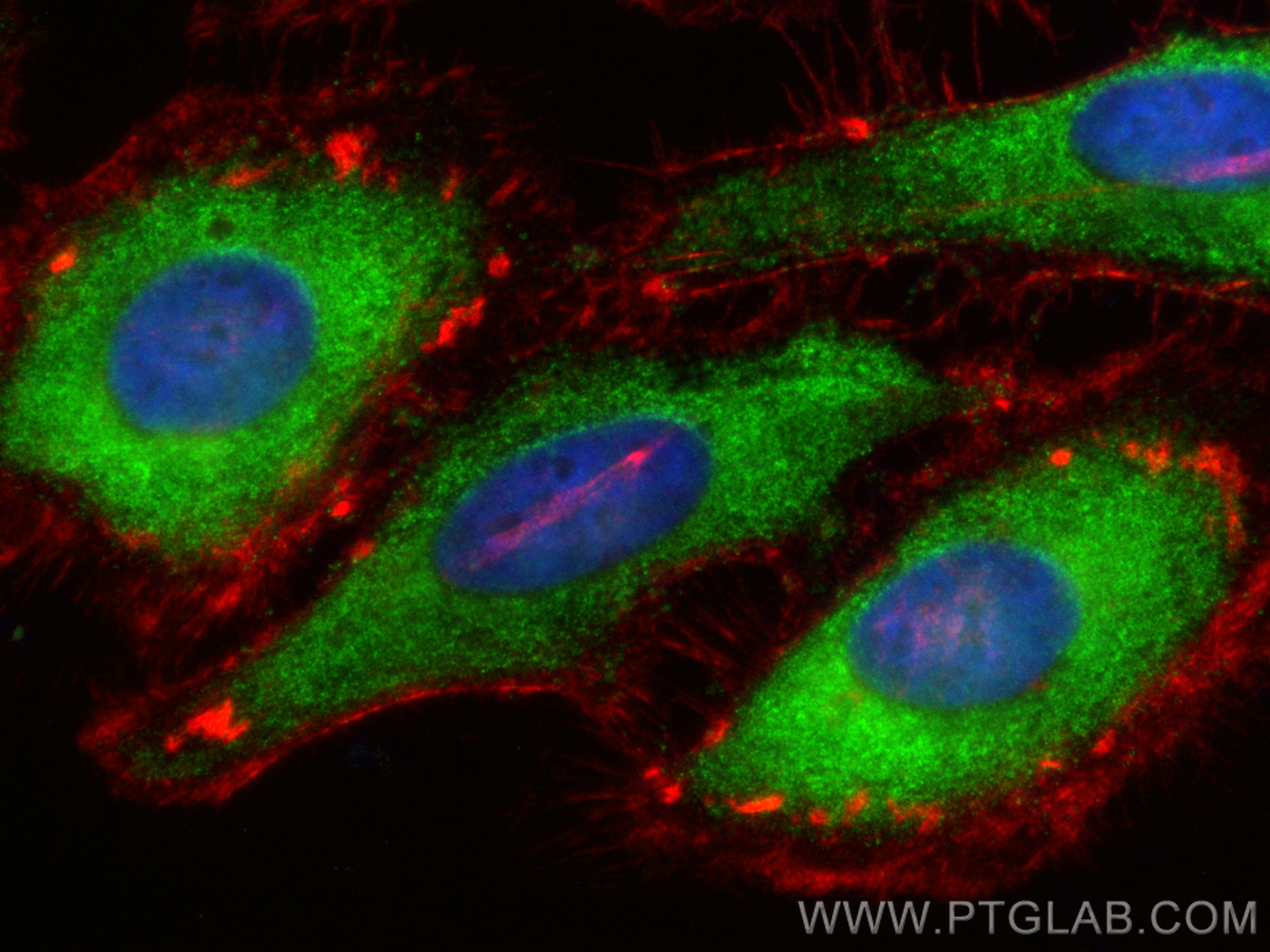 IF Staining of HeLa using CL488-18843