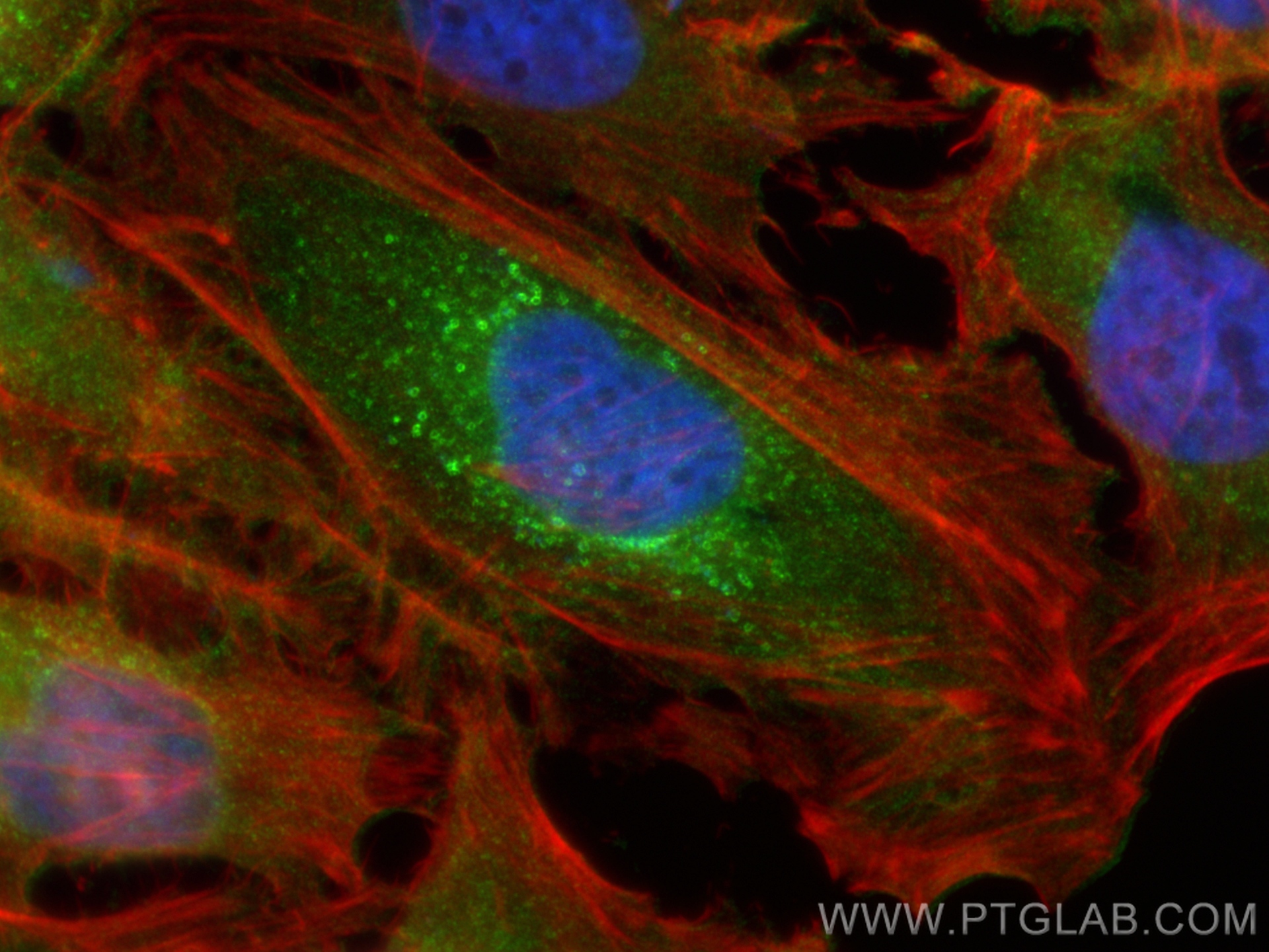 IF Staining of HeLa using 11718-1-AP