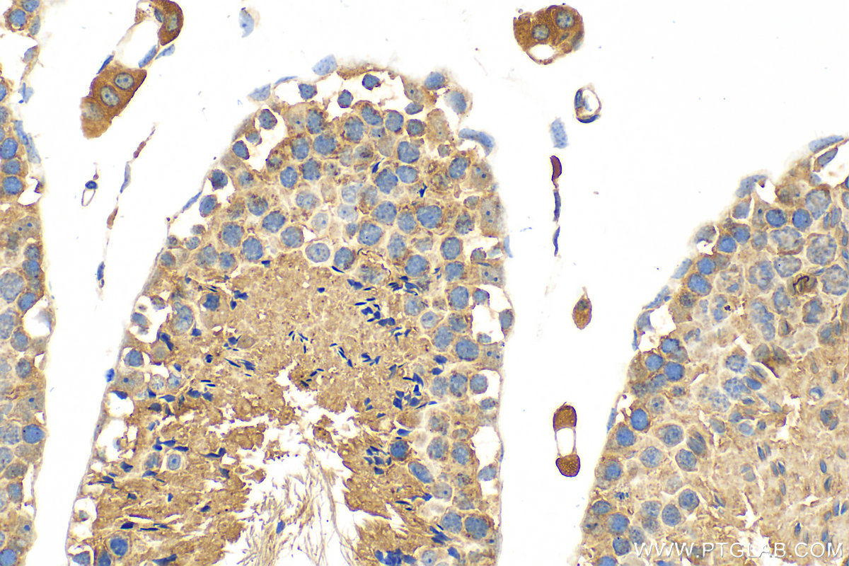 IHC staining of mouse testis using 31416-1-AP