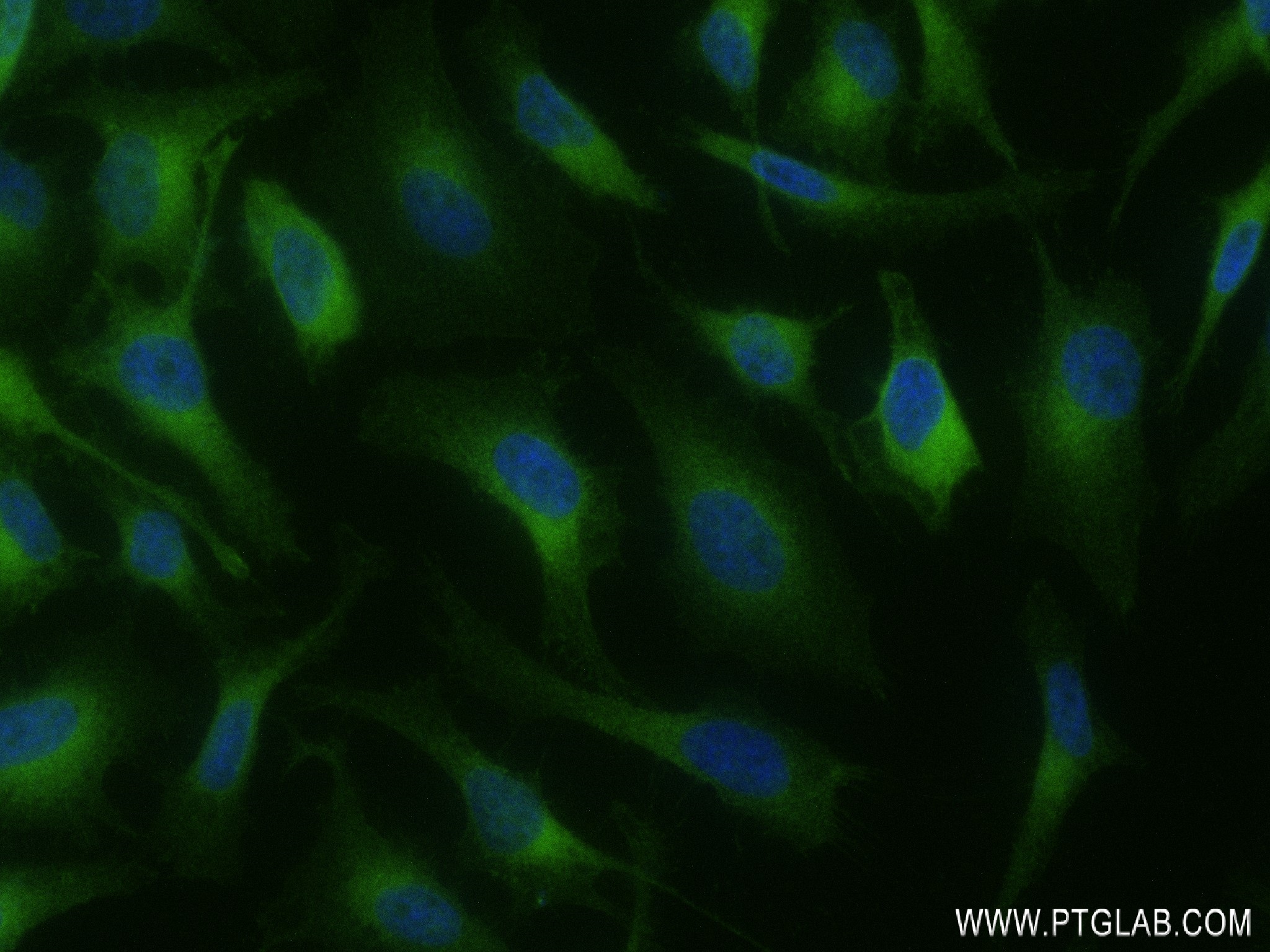 IF Staining of HeLa using 83336-2-RR (same clone as 83336-2-PBS)