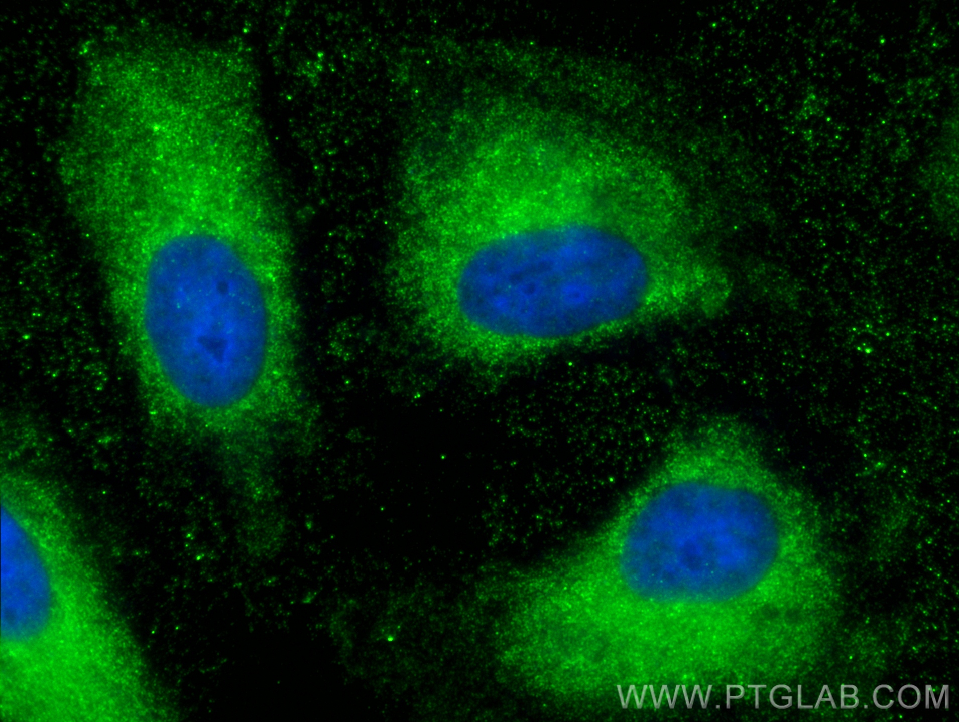 IF Staining of HeLa using 67953-1-Ig (same clone as 67953-1-PBS)