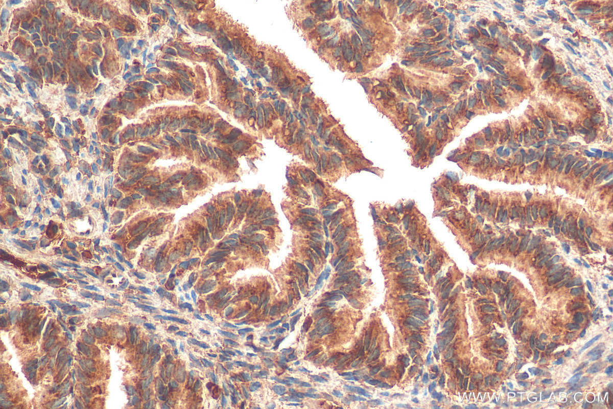 IHC staining of mouse ovary using 67953-1-Ig (same clone as 67953-1-PBS)