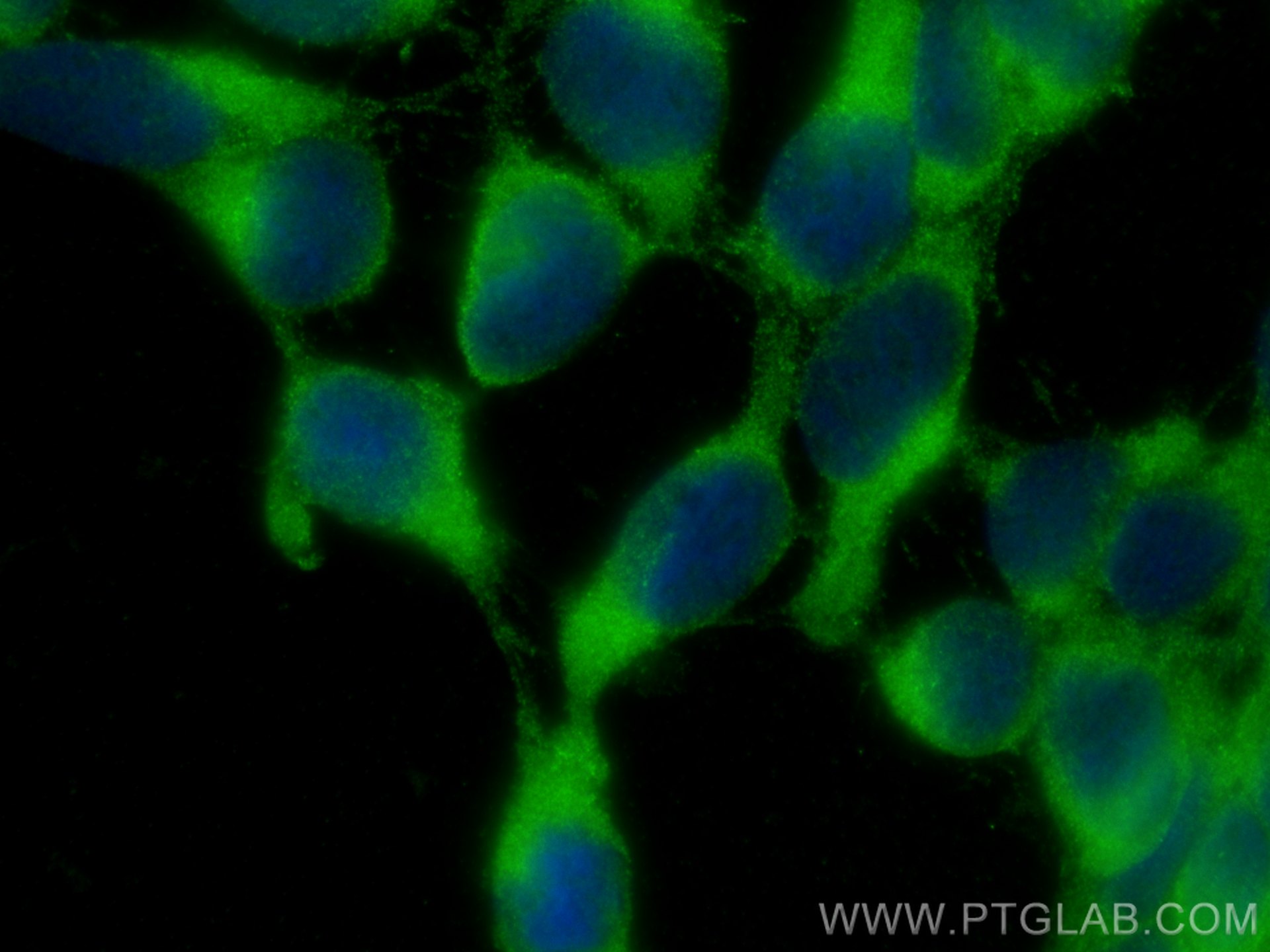 IF Staining of HEK-293 using 11304-1-AP