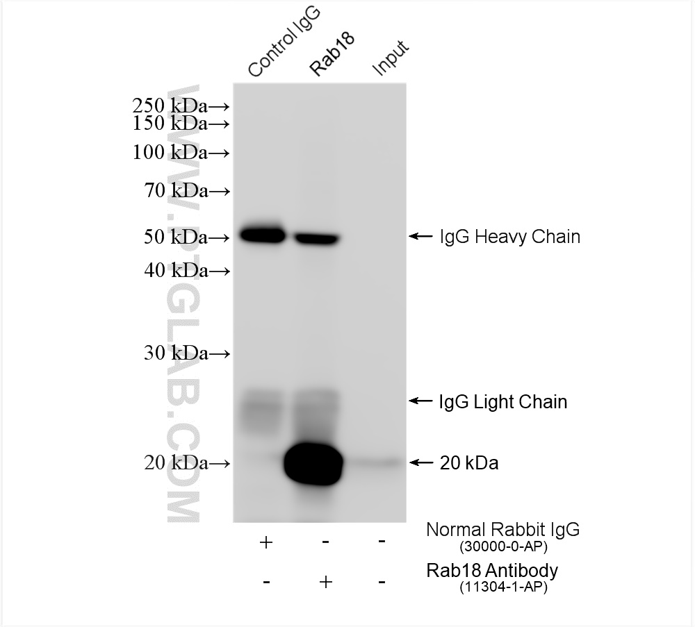 IP experiment of rat testis using 11304-1-AP