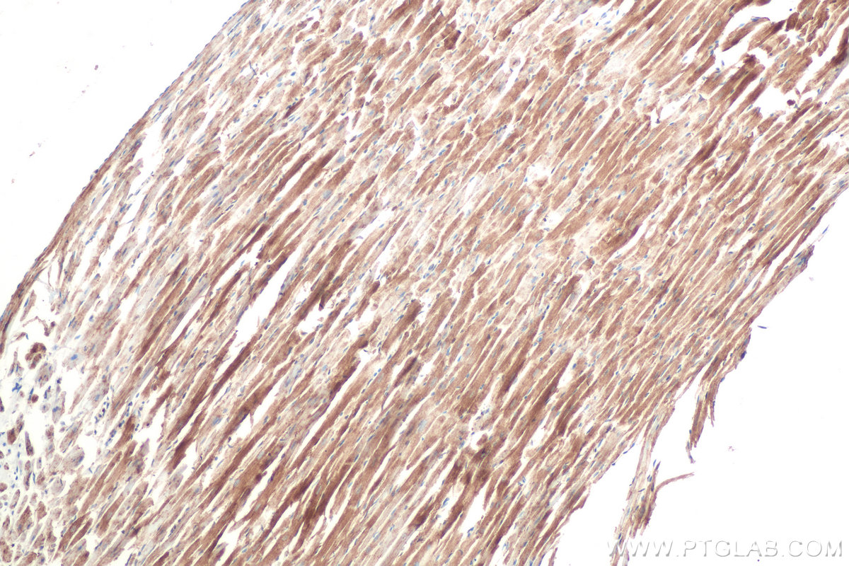 IHC staining of rat heart using 67837-1-Ig (same clone as 67837-1-PBS)