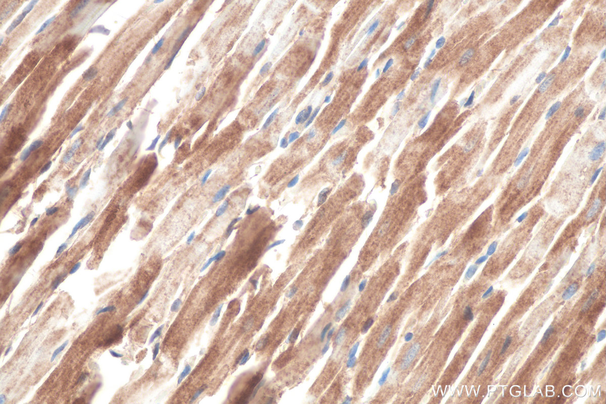 IHC staining of rat heart using 67837-1-Ig (same clone as 67837-1-PBS)