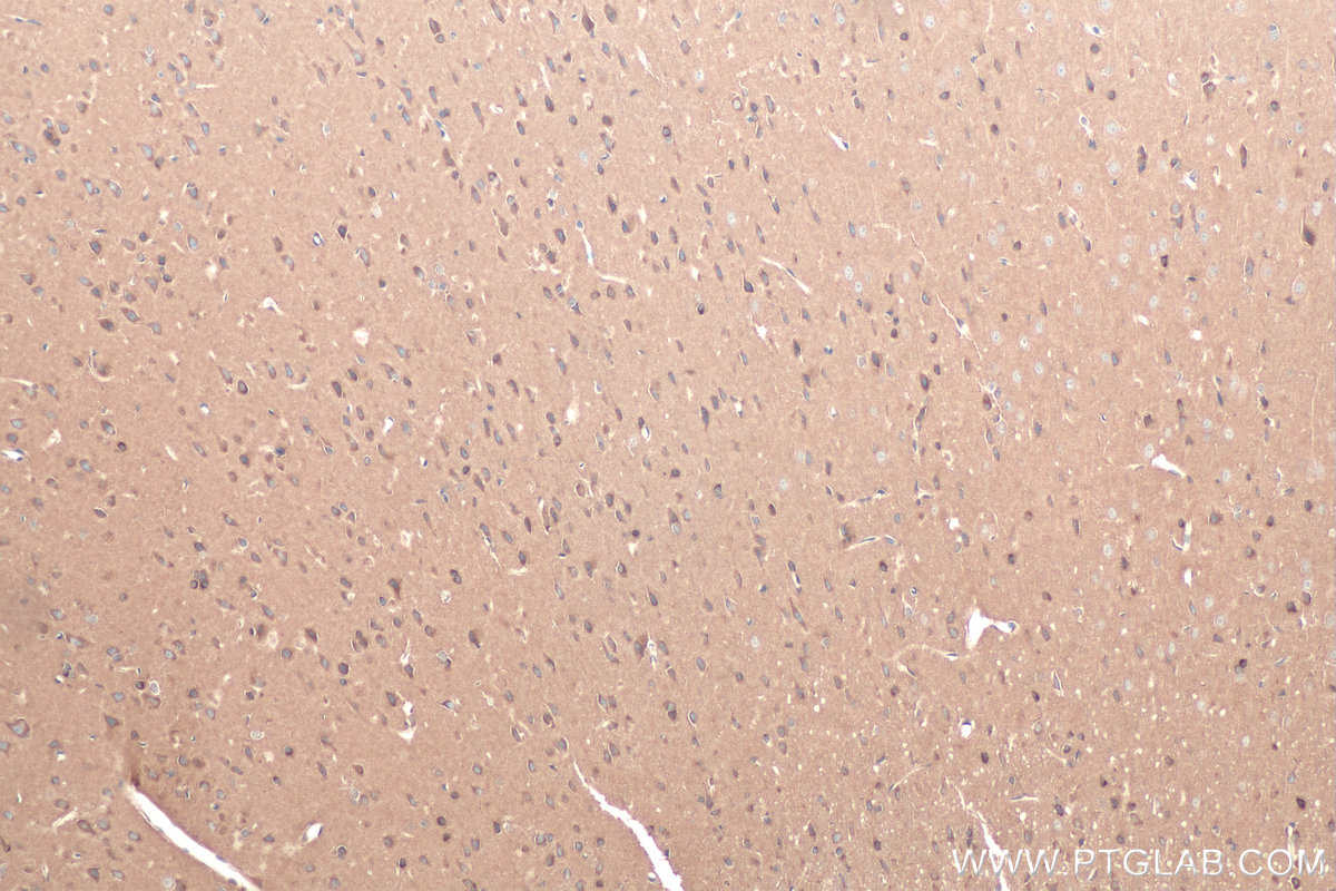 IHC staining of rat brain using 67837-1-Ig (same clone as 67837-1-PBS)