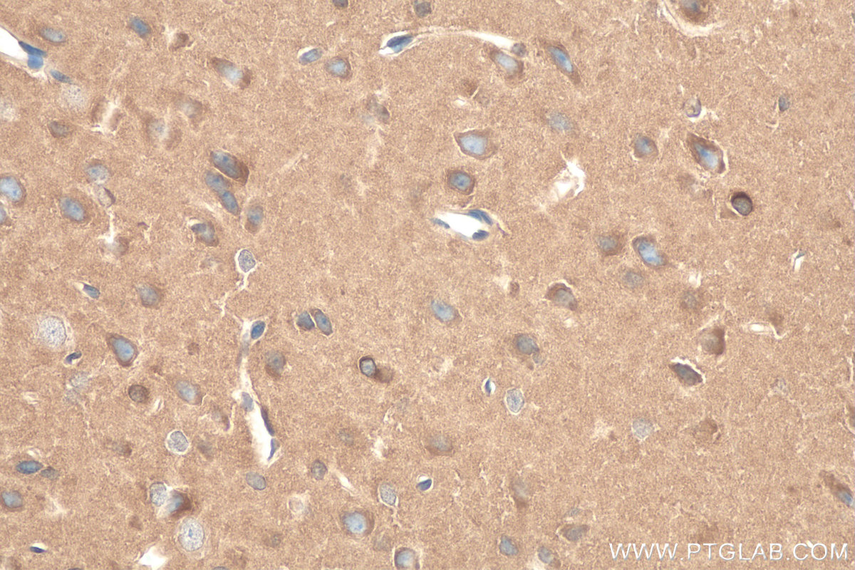 IHC staining of rat brain using 67837-1-Ig (same clone as 67837-1-PBS)