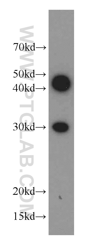 RAB20 Polyclonal antibody