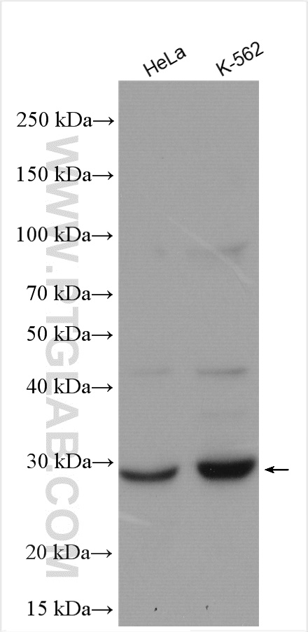 WB analysis using 29110-1-AP