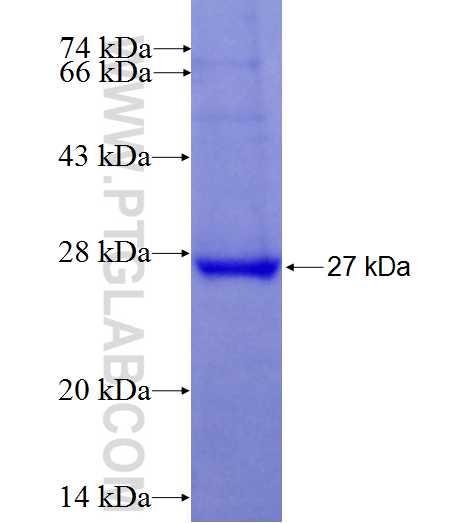 RAB25 fusion protein Ag27011 SDS-PAGE