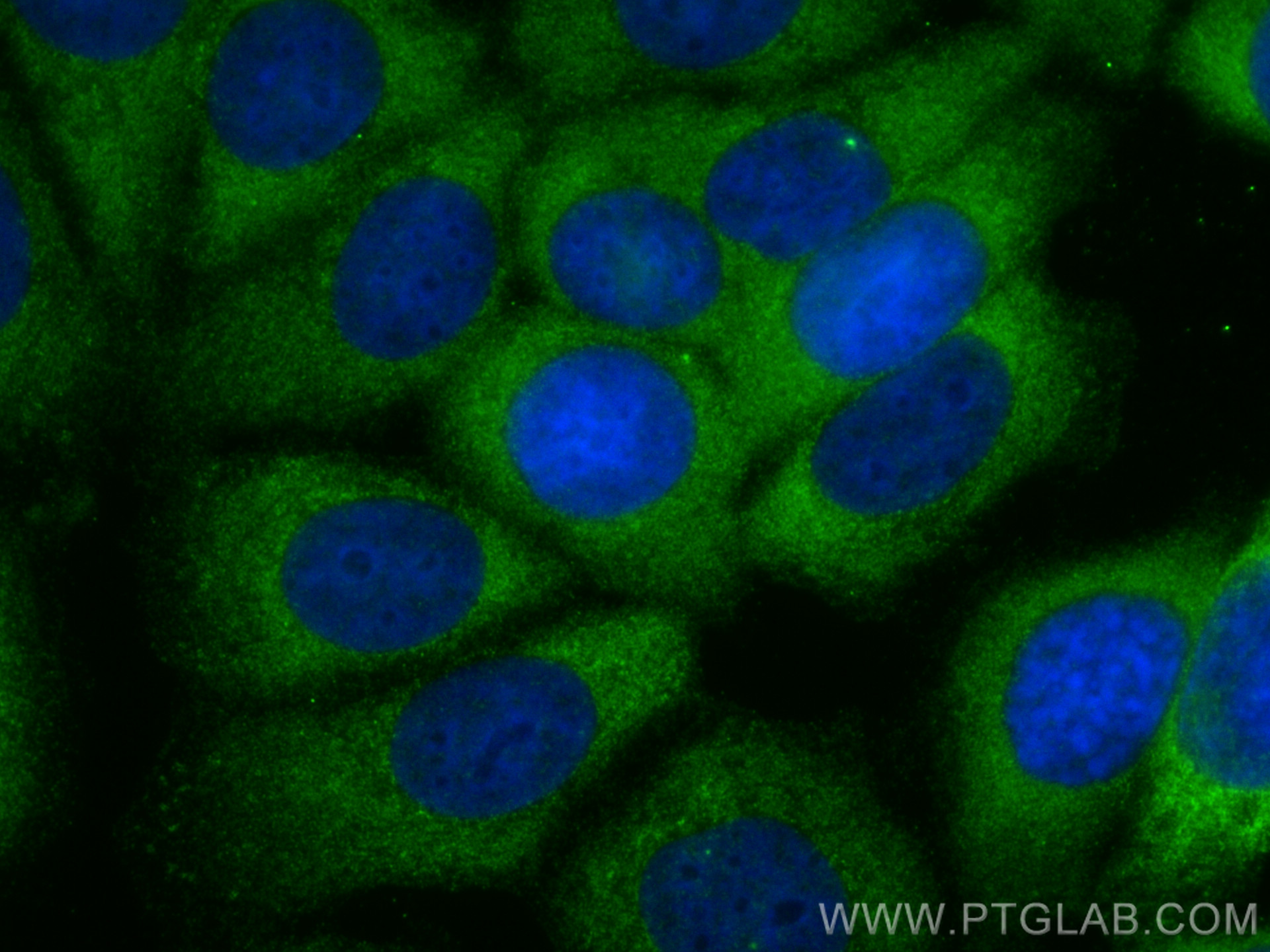 IF Staining of MCF-7 using 14284-1-AP