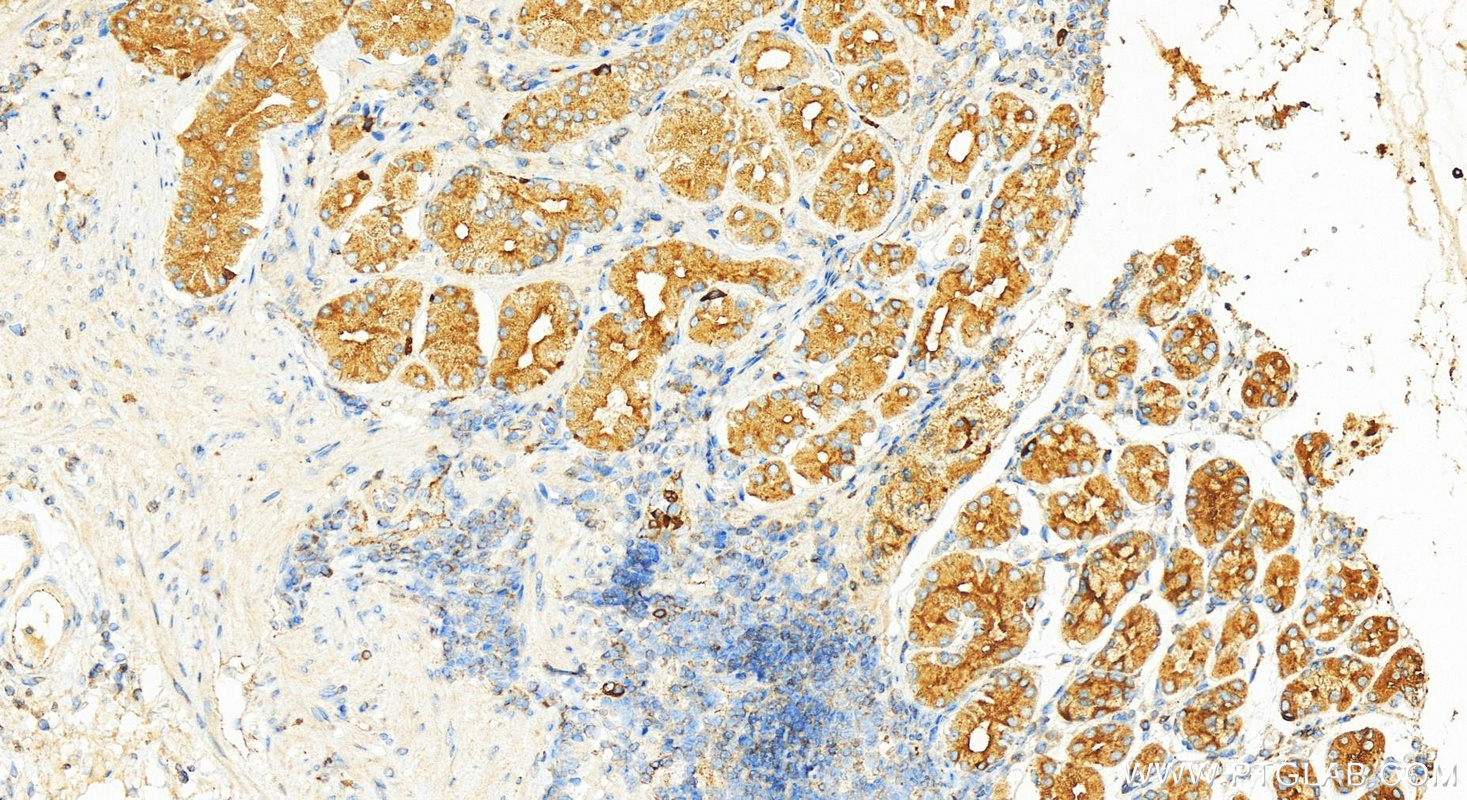 IHC staining of human stomach using 17817-1-AP