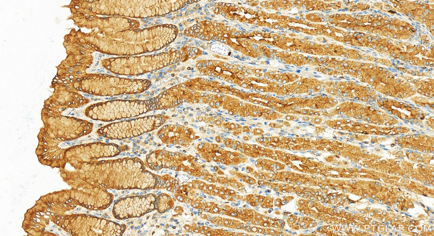 IHC staining of human stomach using 17817-1-AP