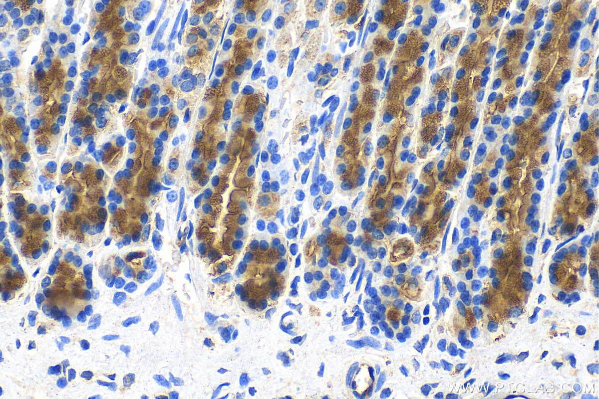 IHC staining of rat stomach using 13412-1-AP