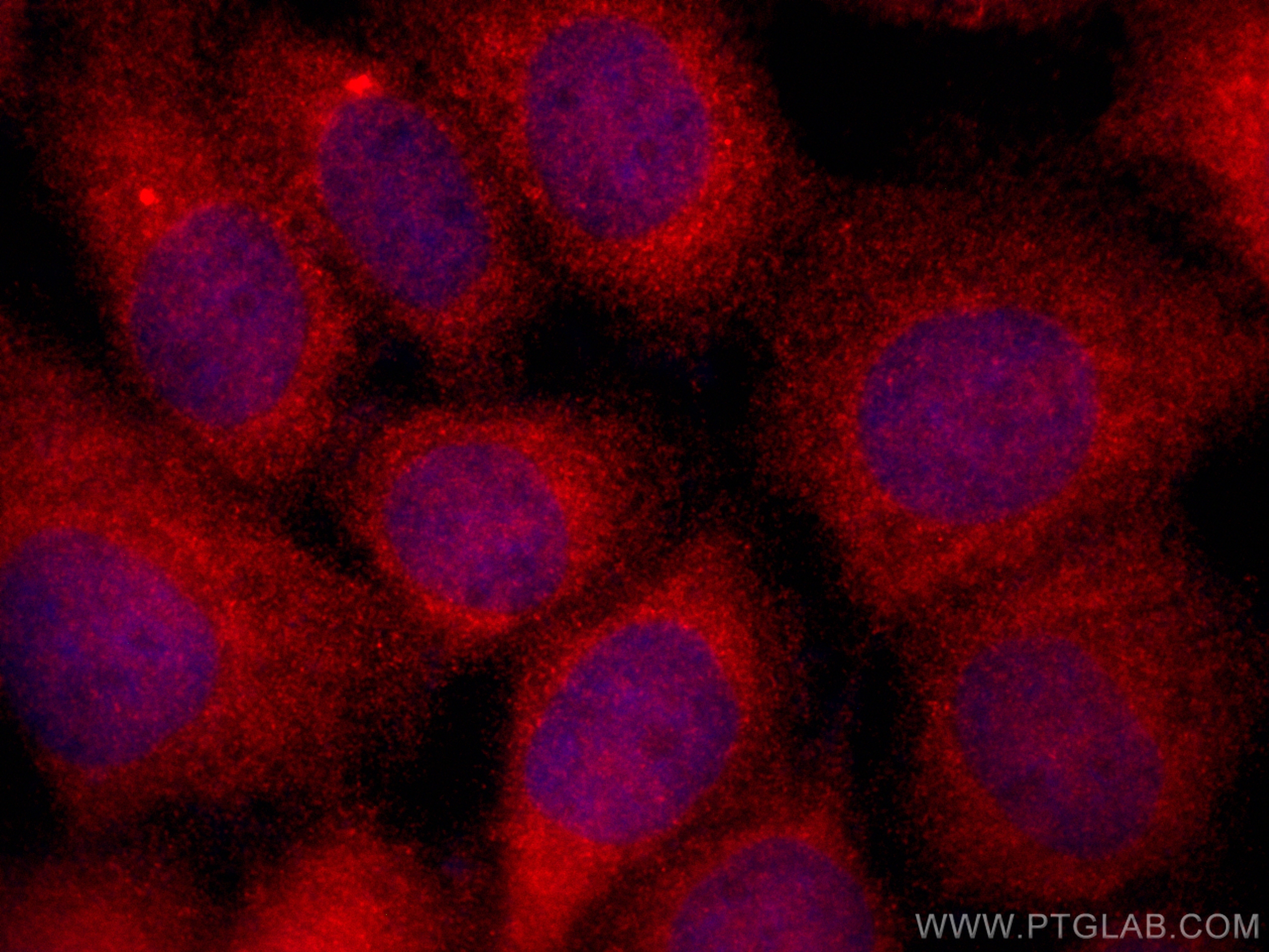 IF Staining of A431 using CL594-13412