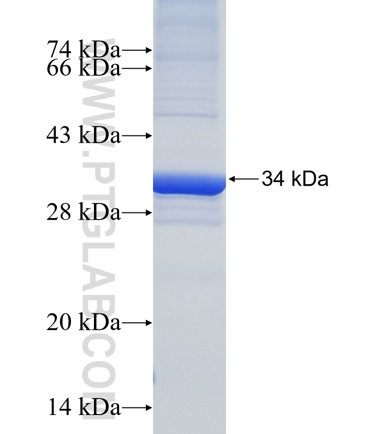 RAB28 fusion protein Ag4796 SDS-PAGE