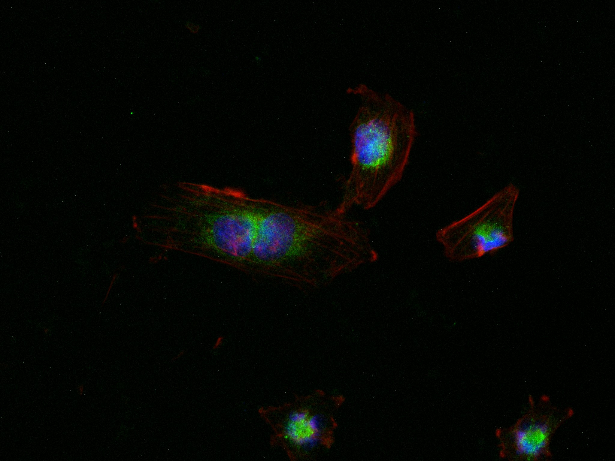 IF Staining of U-251 using 82960-5-RR