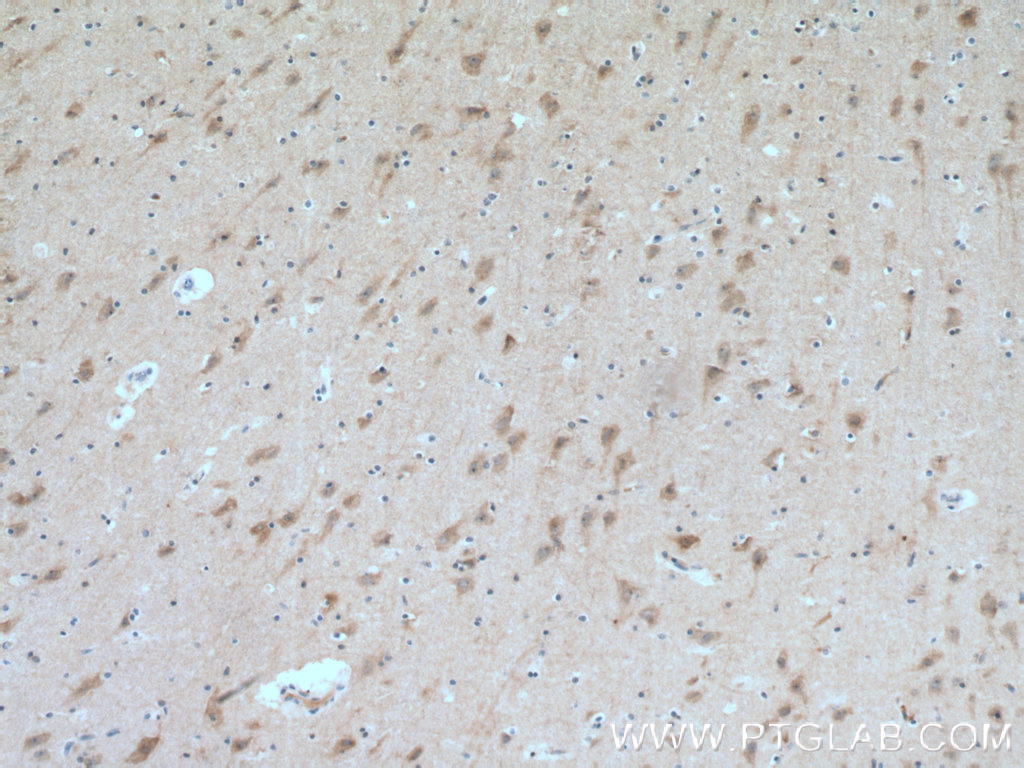 IHC staining of human brain using 11025-1-AP