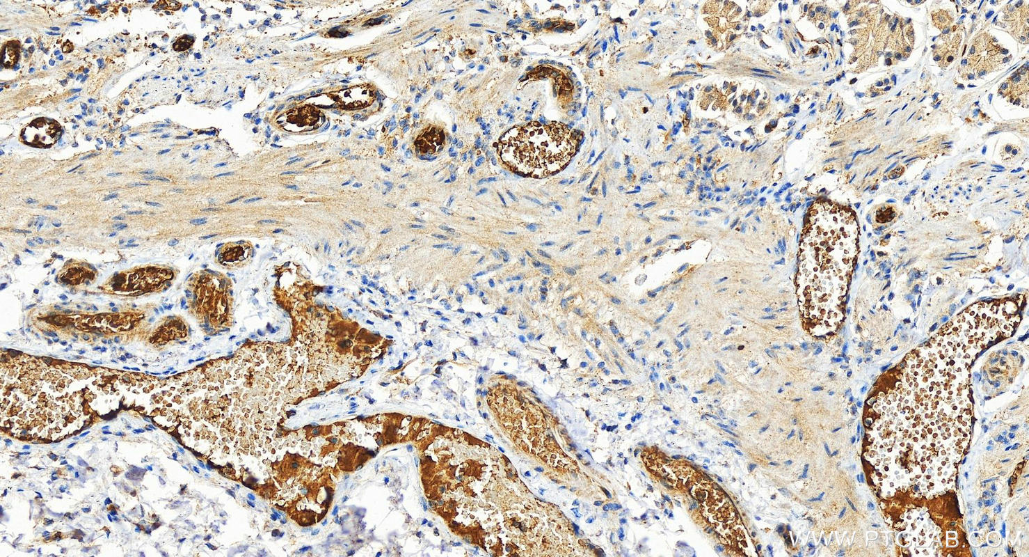 IHC staining of human stomach using 27349-1-AP