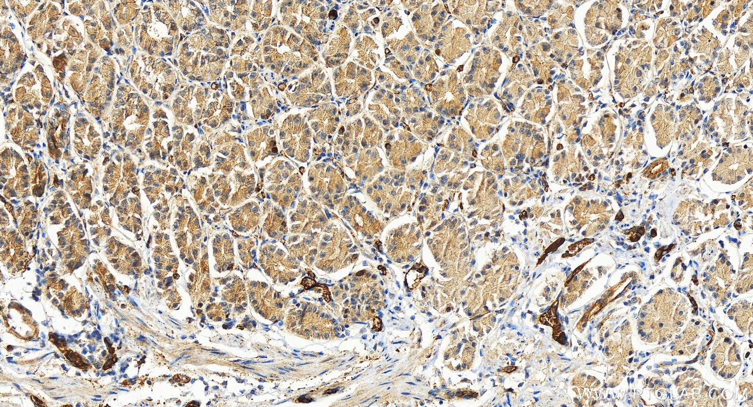 IHC staining of human stomach using 27349-1-AP