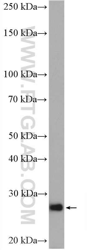 WB analysis of HeLa using 27349-1-AP