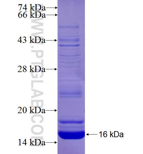 RAB34 fusion protein Ag26709 SDS-PAGE