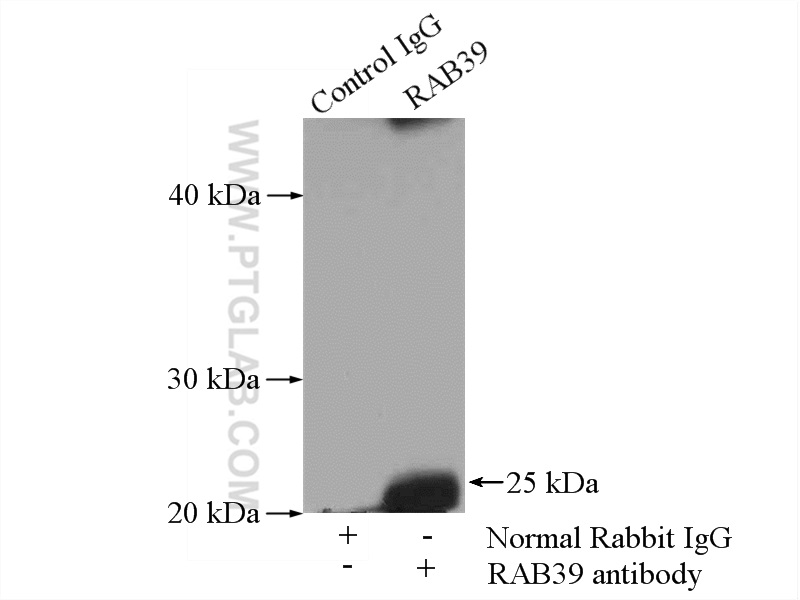 IP experiment of mouse brain using 13355-1-AP