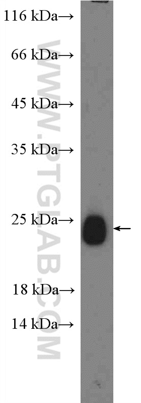 WB analysis of mouse brain using 13355-1-AP