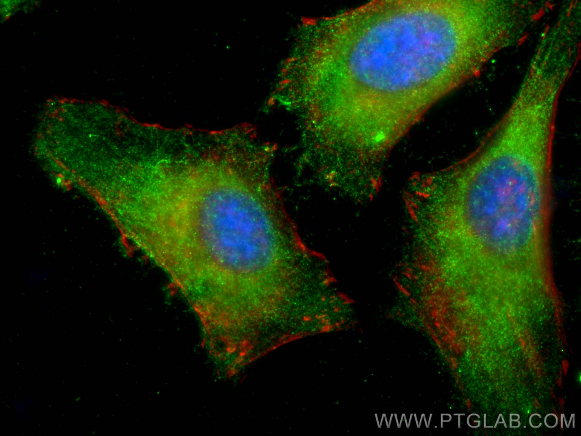 IF Staining of HeLa using 16865-1-AP