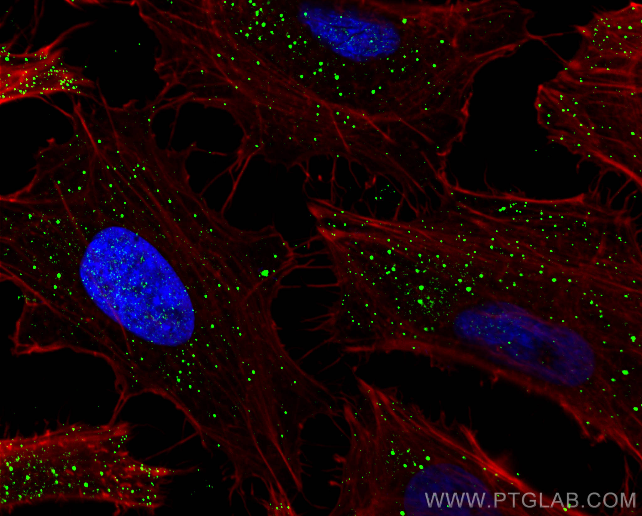 IF Staining of HeLa using 10347-1-AP