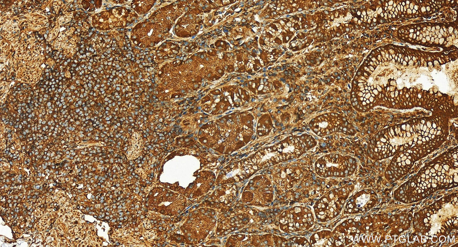 IHC staining of human stomach using 27403-1-AP