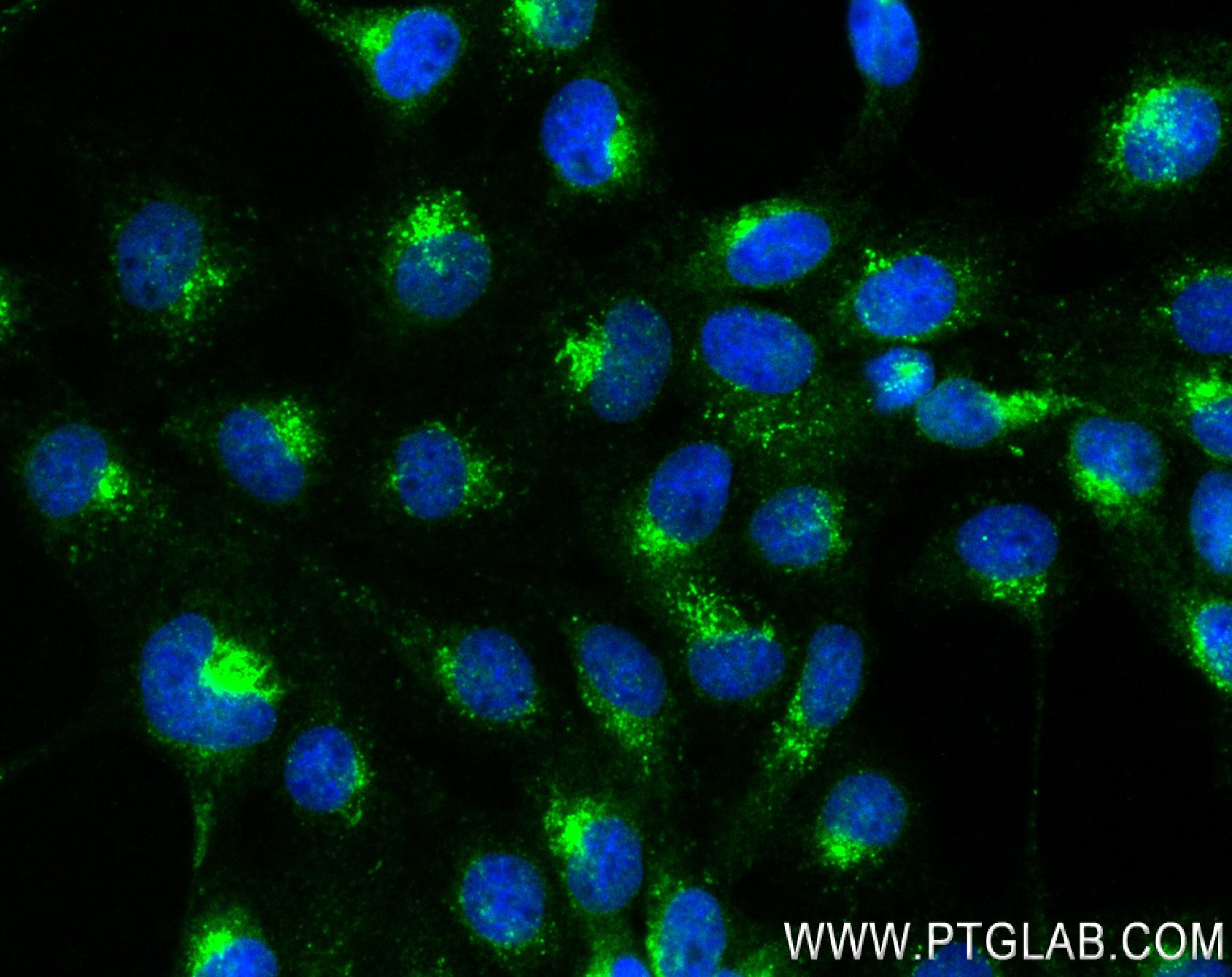 IF Staining of A431 using 84741-1-RR (same clone as 84741-1-PBS)