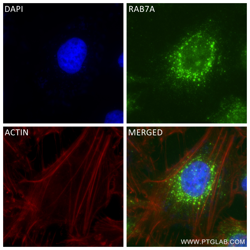 IF Staining of HeLa using 84741-1-RR