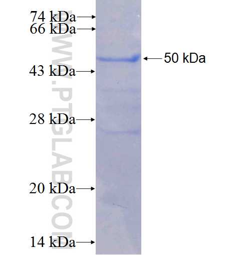 RABEP2 fusion protein Ag6197 SDS-PAGE