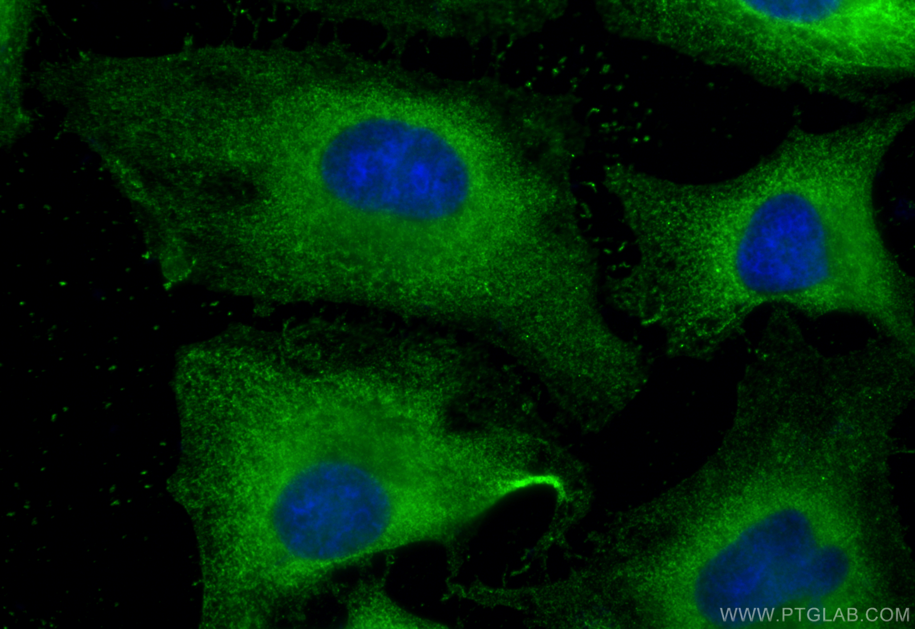 IF Staining of HeLa using 66622-1-Ig (same clone as 66622-1-PBS)