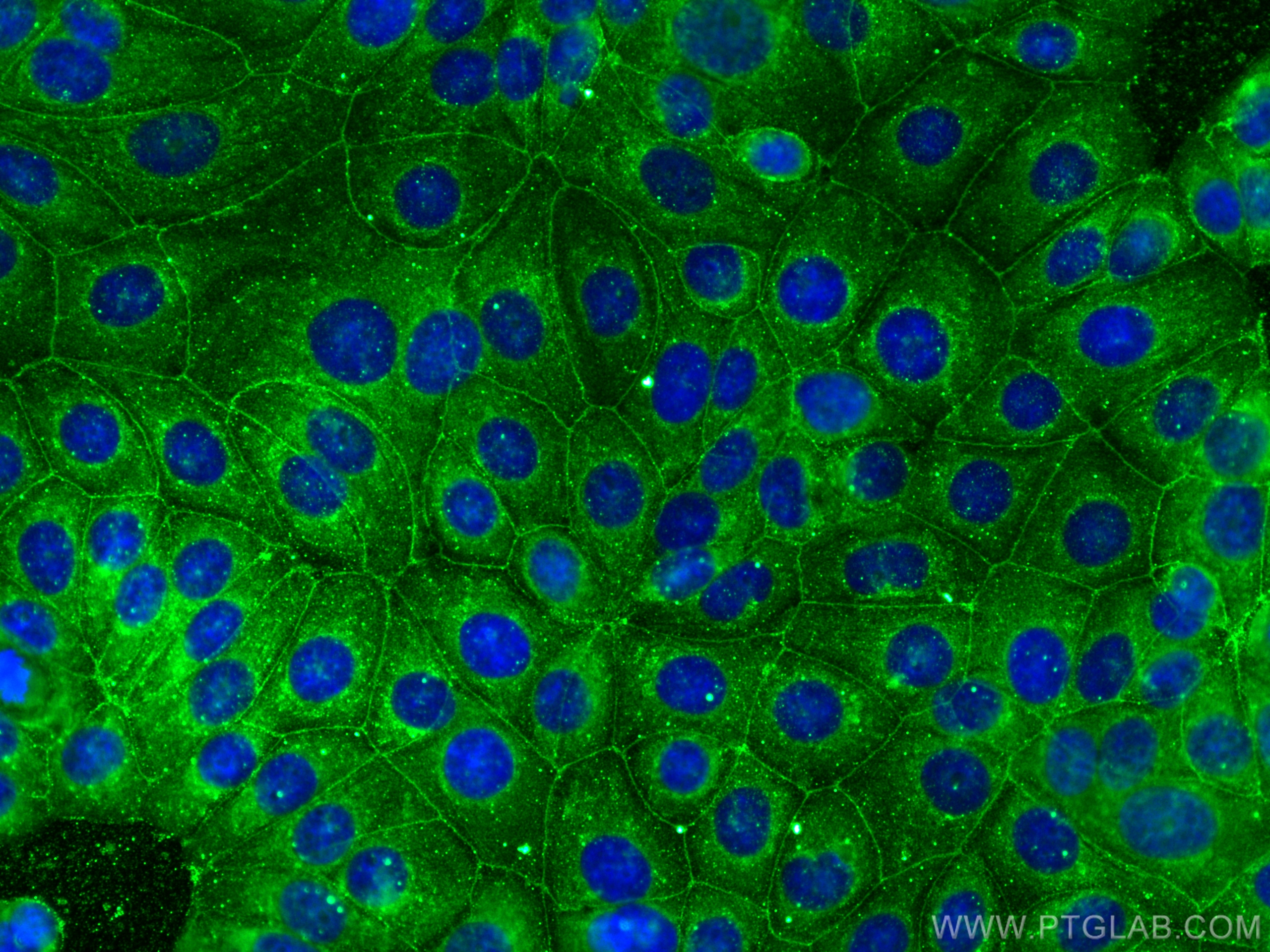 IF Staining of MCF-7 using 29113-1-AP