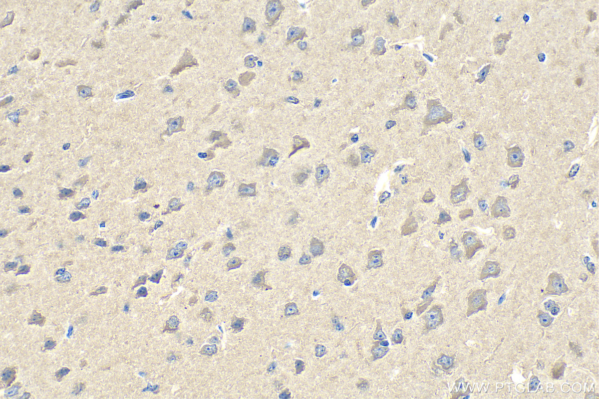 IHC staining of mouse brain using 29113-1-AP