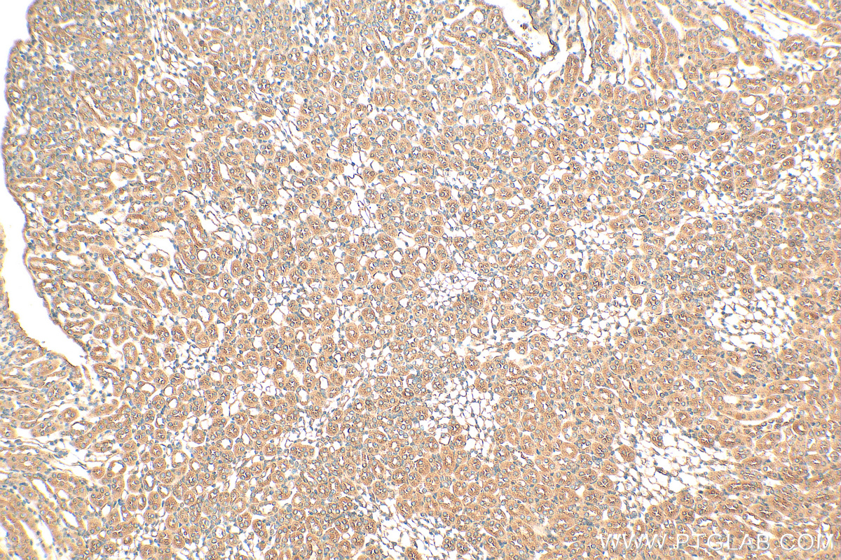 IHC staining of mouse kidney using 11588-1-AP