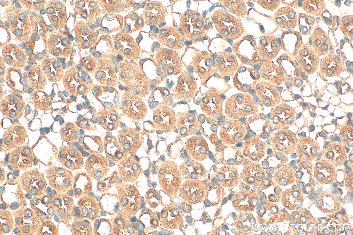 IHC staining of mouse kidney using 11588-1-AP