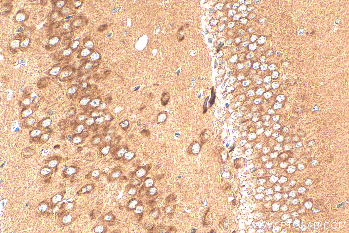 IHC staining of mouse brain using 11588-1-AP