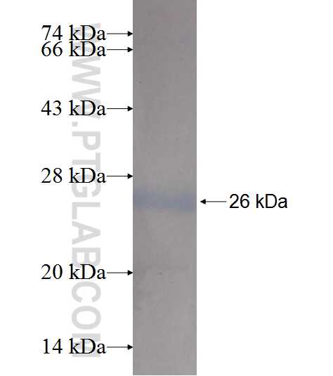 RAC1/2/3 fusion protein Ag9064 SDS-PAGE