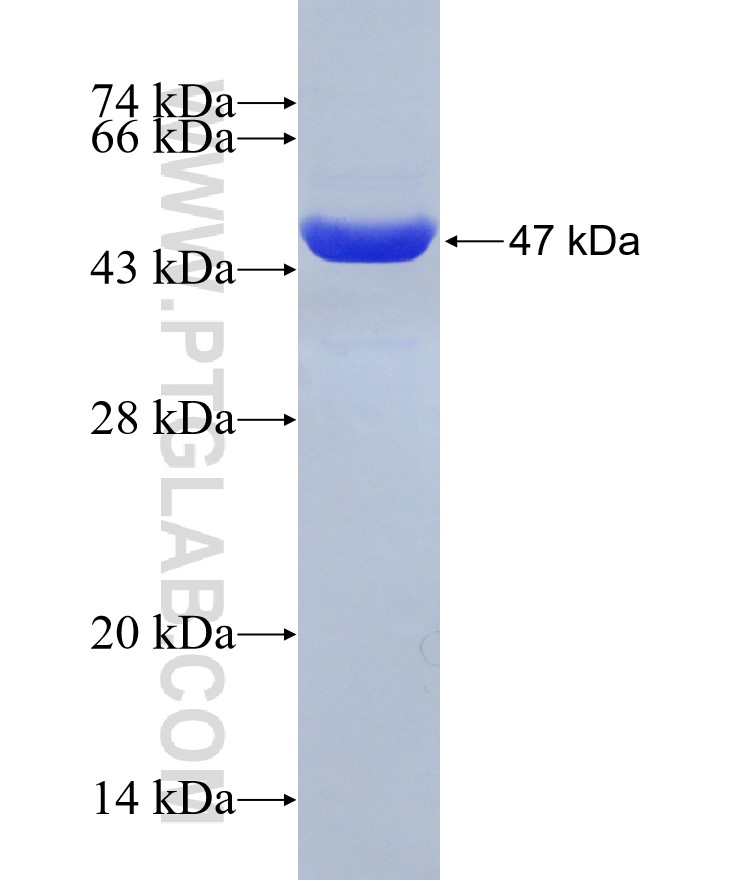 RAC1 fusion protein Ag0751 SDS-PAGE