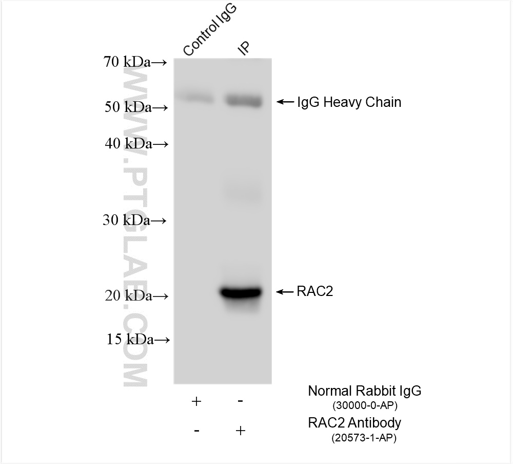 IP experiment of MOLT-4 using 20573-1-AP